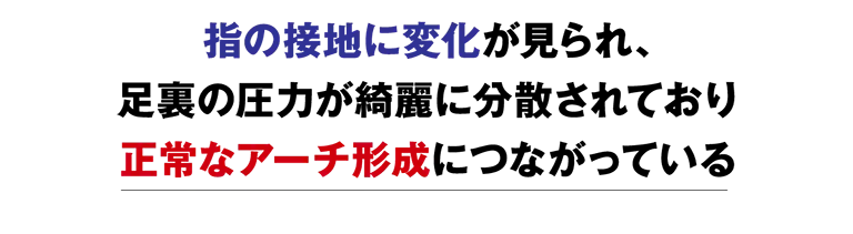 指の接地に変化が見られ、足裏の圧力が綺麗に分散されており正常なアーチ形成につながっている
